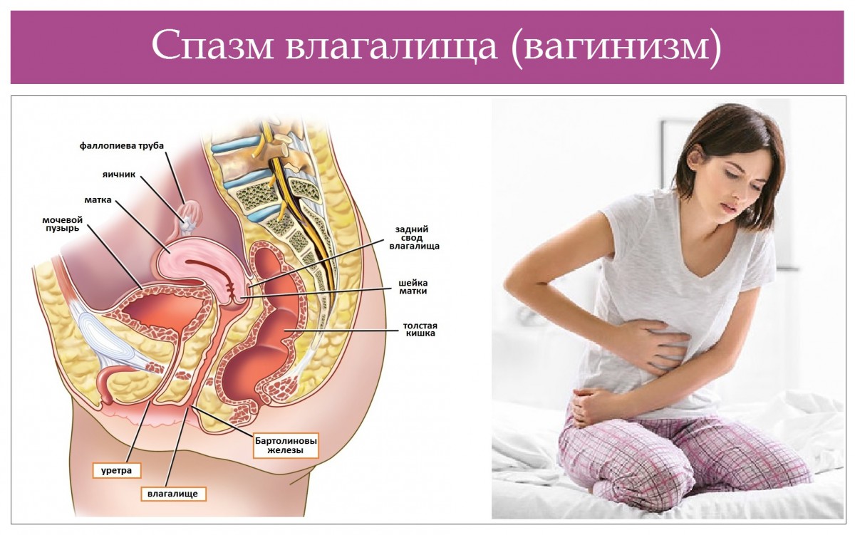 Сексуальный дискомфорт