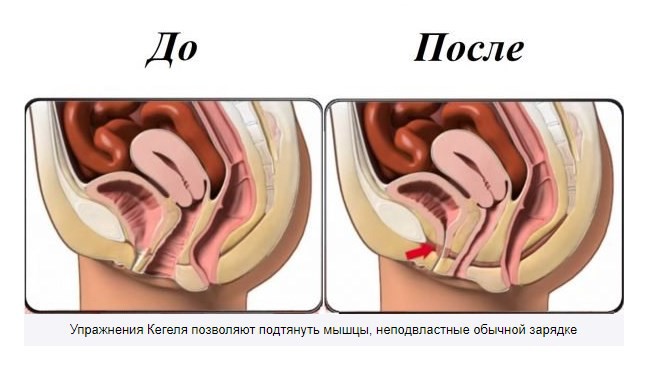 Сексуальный дискомфорт